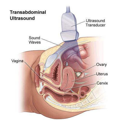 Трансабдоминальное УЗИ