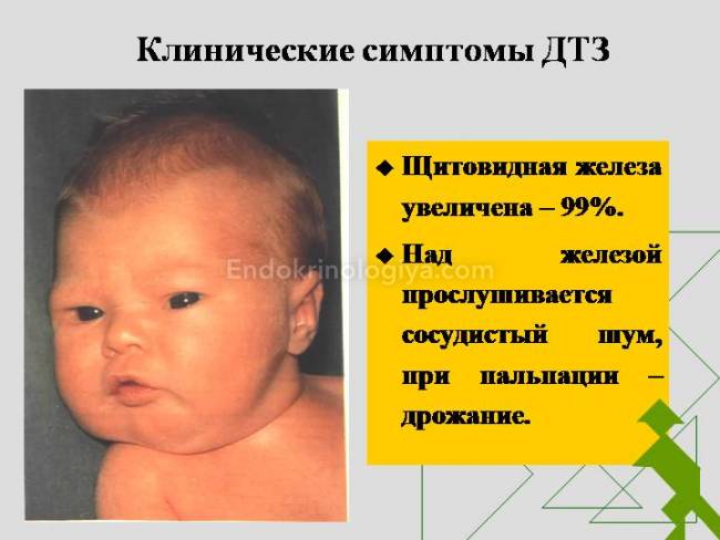 Изображение щитовидной железы у детей