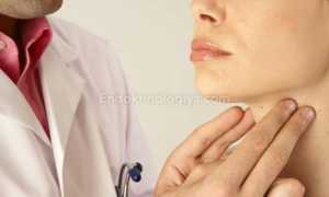 Что означает тиреомегалия щитовидной железы?