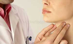 Жизнь после удаления щитовидной железы у мужчин